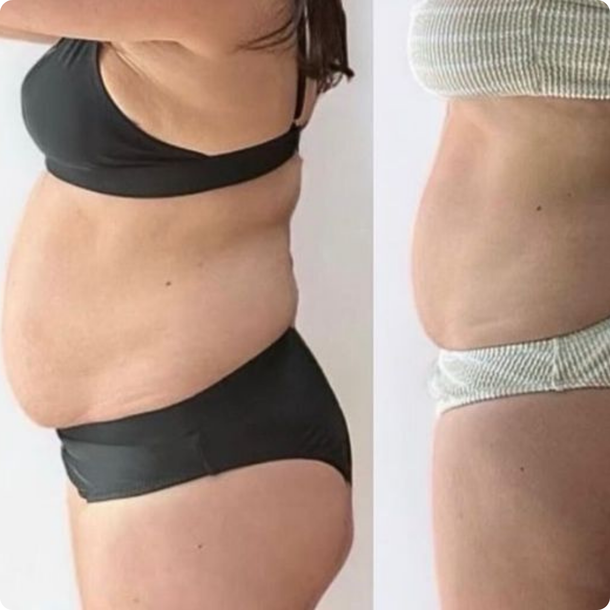 Antesdespues-Polonsky 2