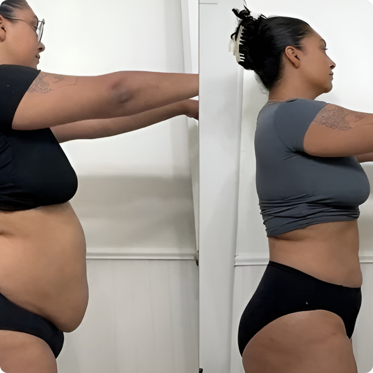 Antesdespues-Polonsky 3