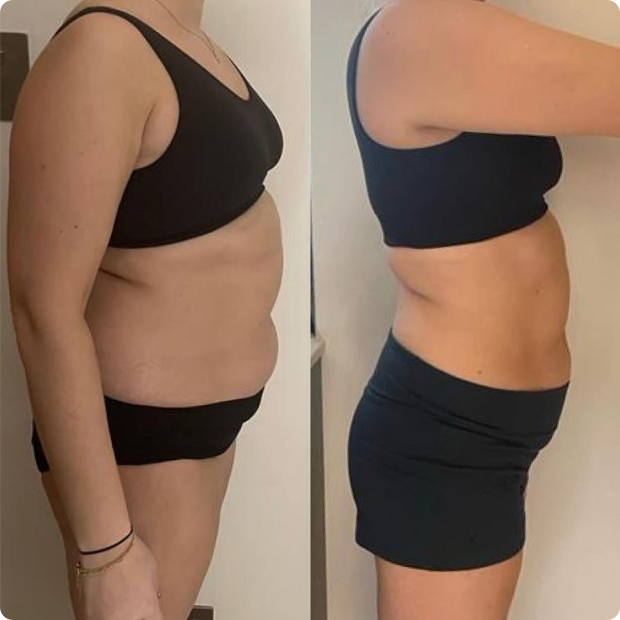 Antesdespues-Polonsky 4