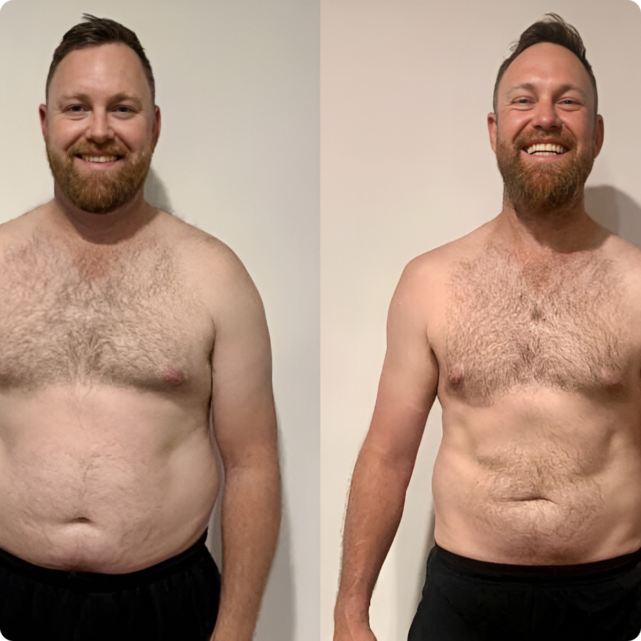 Antesdespues-Polonsky 5