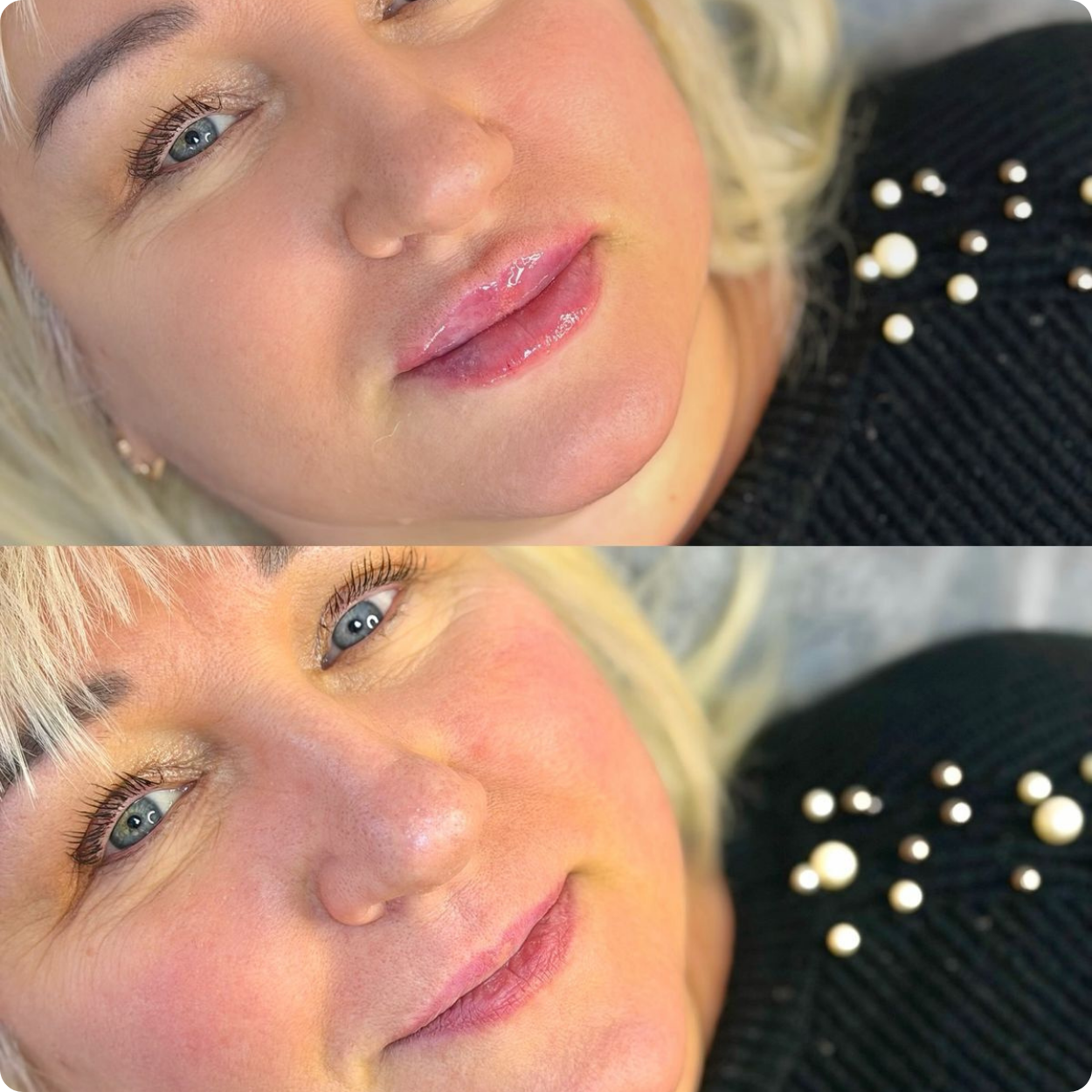 Antesdespues-Polonsky