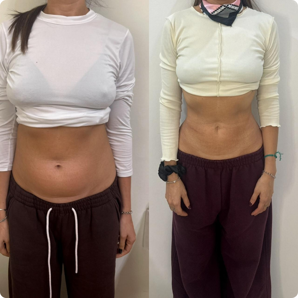 review-antesdespues2